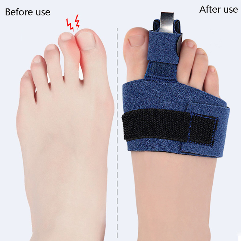 1 шт. Корректор для пальцев но – обзор и цена Ankle Brace Sock